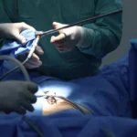 Kapalı safra kesesi ameliyatı