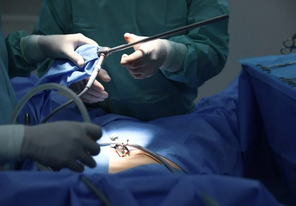 Kapalı safra kesesi ameliyatı