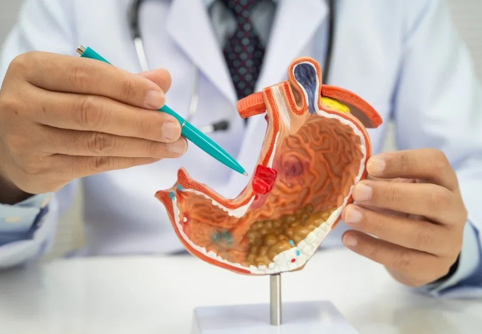 mide kanseri belirtileri